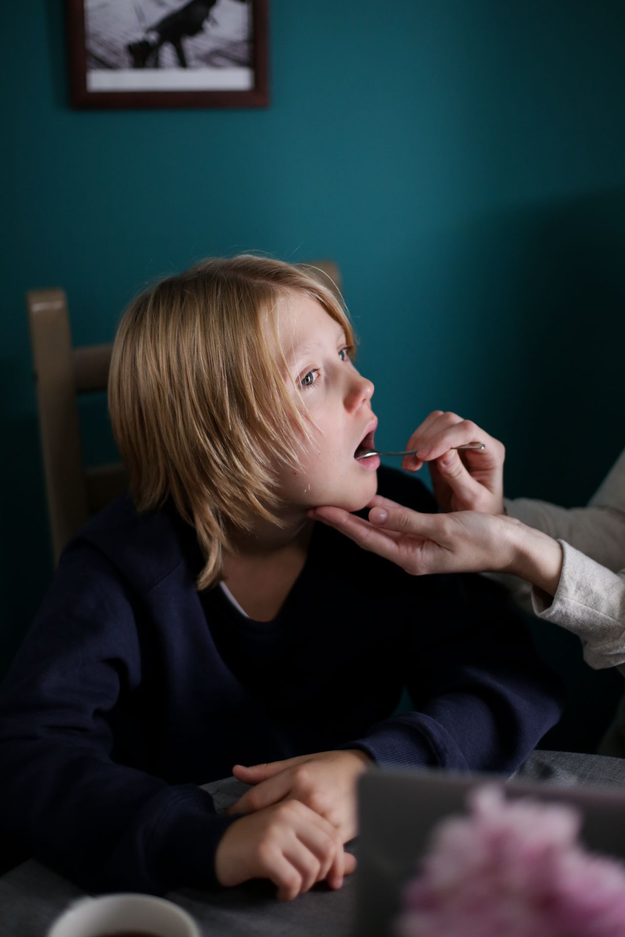 Bé hay bị loét miệng, nhiệt miệng tái đi tái lại có phải thiếu vitamin không?